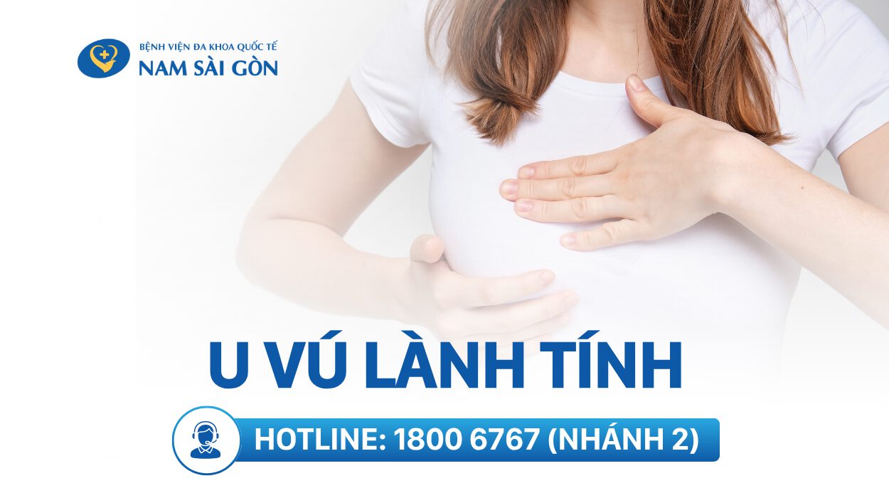 7 LOẠI U VÚ LÀNH TÍNH THƯỜNG GẶP – DẤU HIỆU, NGUYÊN NHÂN VÀ CÁCH ĐIỀU TRỊ HIỆU QUẢ