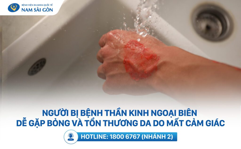 đau thần kinh ngoại biên