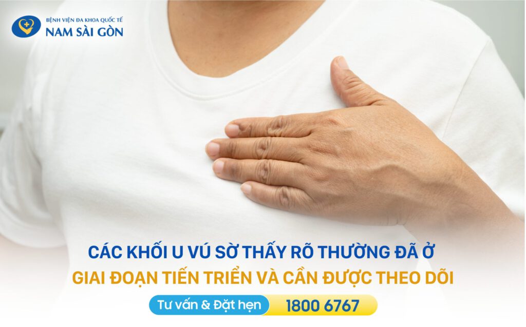 các giai đoạn của ung thư vú