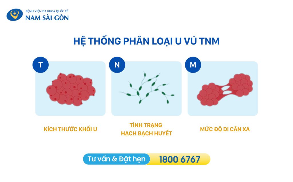 ung thư vú có mấy giai đoạn