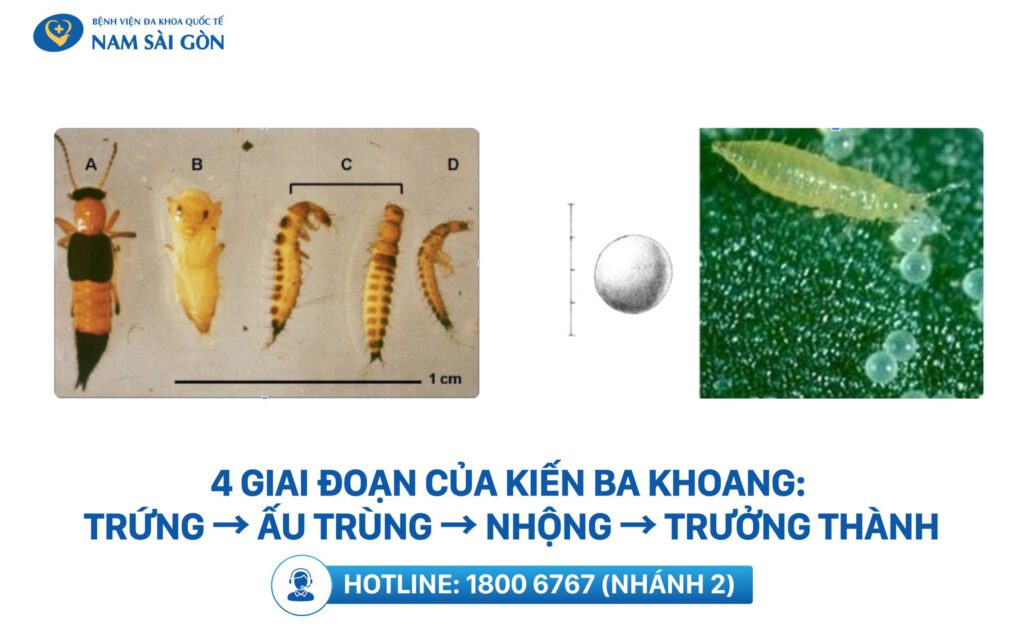 kiến 3 khoang