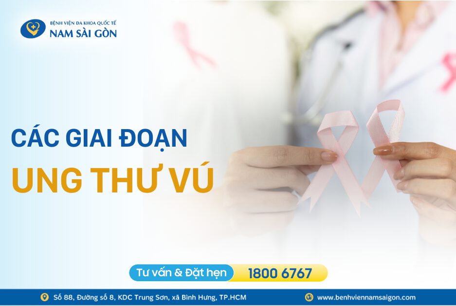 5 GIAI ĐOẠN UNG THƯ VÚ VÀ HƯỚNG ĐIỀU TRỊ