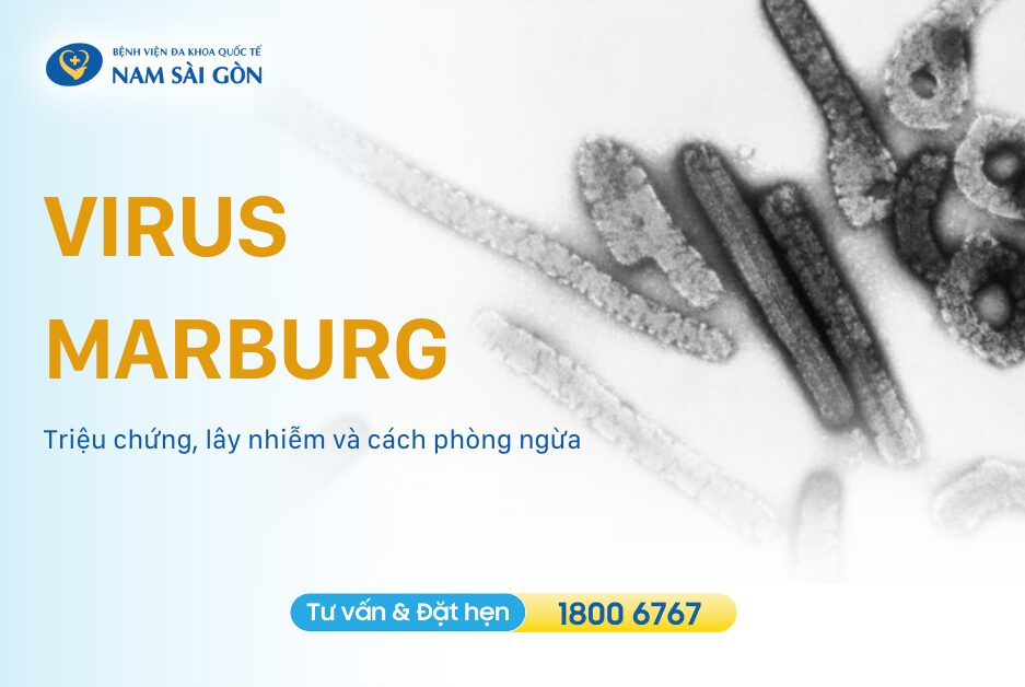 VIRUS MARBURG – TRIỆU CHỨNG, LÂY NHIỄM VÀ CÁCH PHÒNG NGỪA