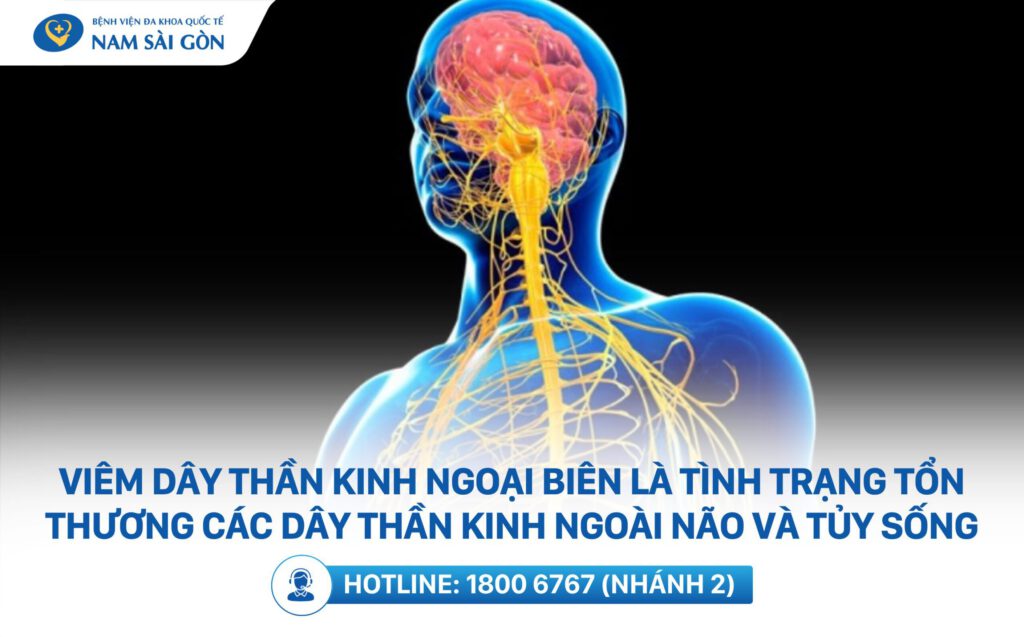 viêm dây thần kinh ngoại biên