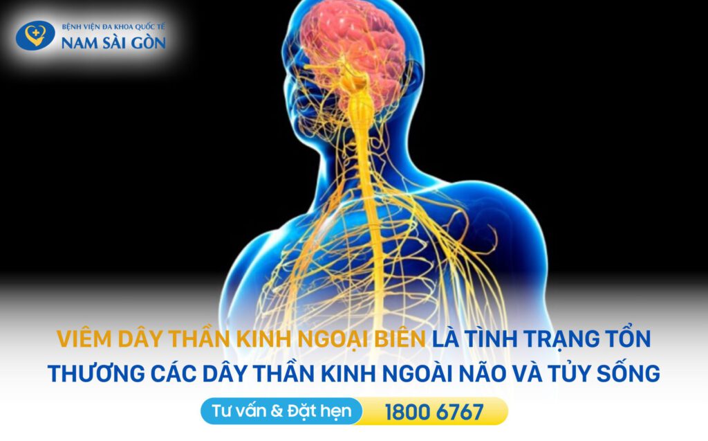 VIÊM DÂY THẦN KINH NGOẠI BIÊN - NGUYÊN NHÂN, TRIỆU CHỨNG, CHẨN ĐOÁN, ĐIỀU TRỊ 2 Viêm dây thần kinh ngoại biên