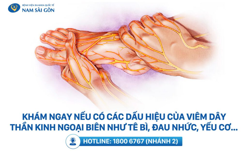 phòng ngừa bệnh viêm dây thần kinh ngoại biên