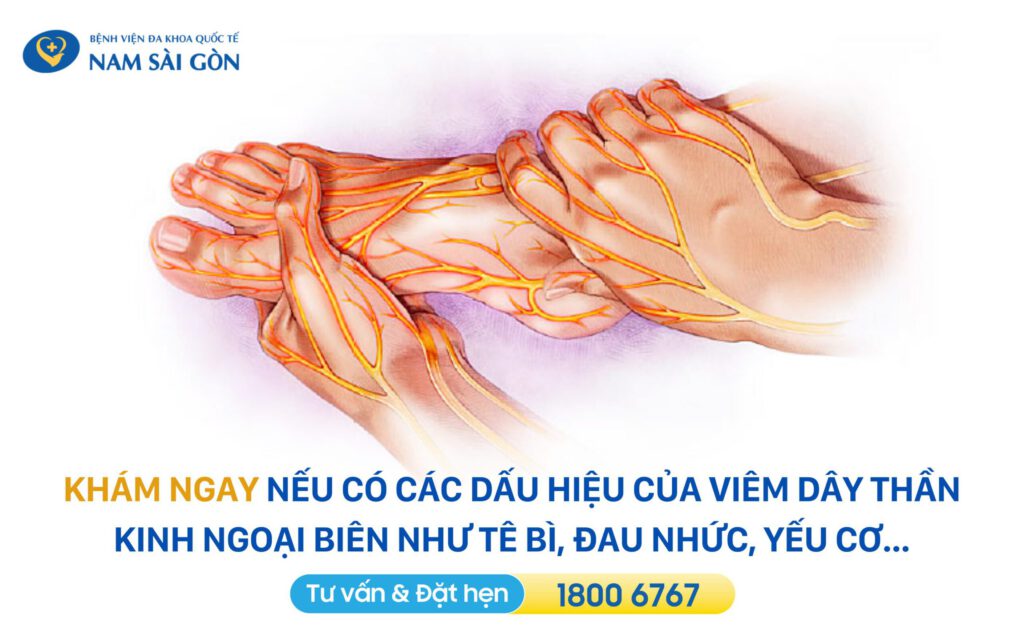 VIÊM DÂY THẦN KINH NGOẠI BIÊN - NGUYÊN NHÂN, TRIỆU CHỨNG, CHẨN ĐOÁN, ĐIỀU TRỊ 8 phòng ngừa bệnh viêm dây thần kinh ngoại biên