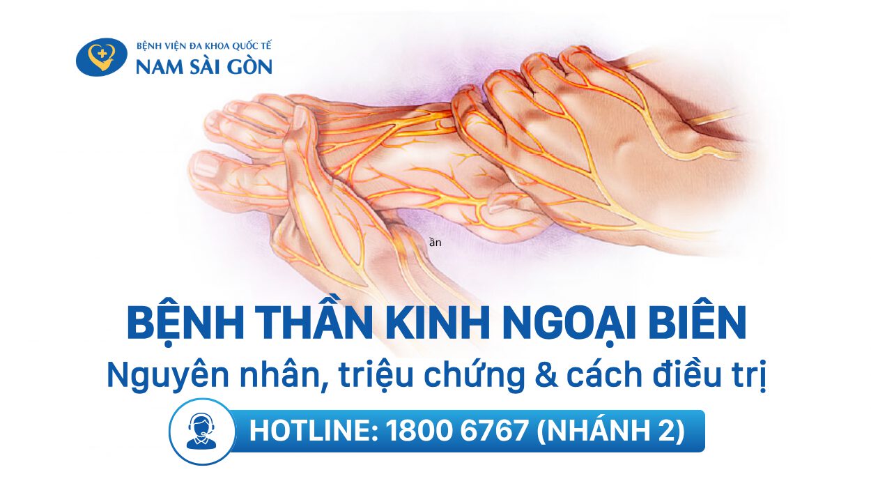 BỆNH THẦN KINH NGOẠI BIÊN – TRIỆU CHỨNG, NGUYÊN NHÂN VÀ PHƯƠNG PHÁP ĐIỀU TRỊ