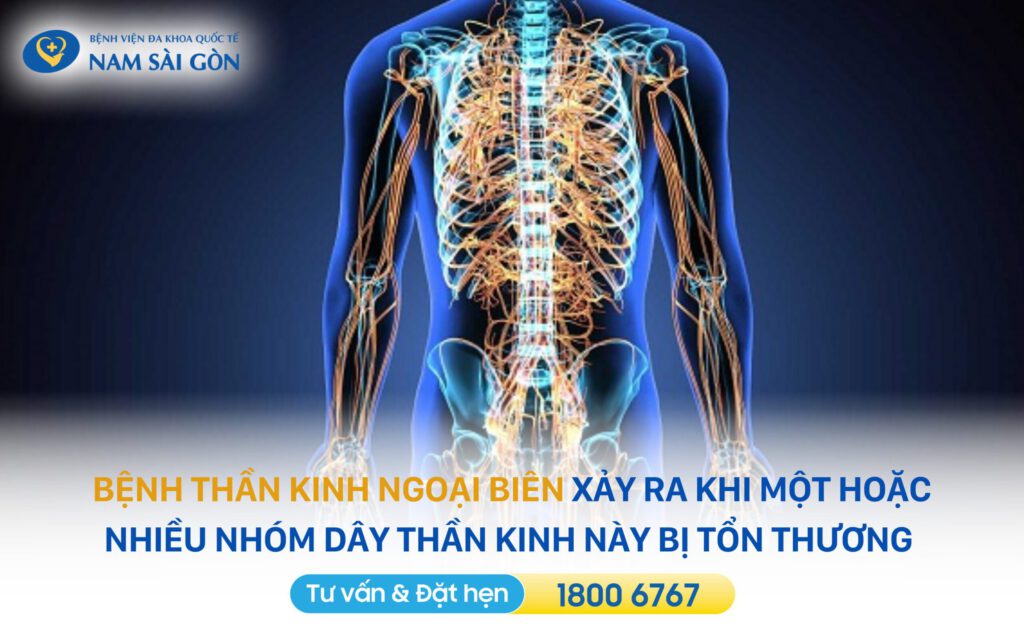 BỆNH THẦN KINH NGOẠI BIÊN - TRIỆU CHỨNG, NGUYÊN NHÂN VÀ PHƯƠNG PHÁP ĐIỀU TRỊ 2 bệnh thần kinh ngoại biên là gì