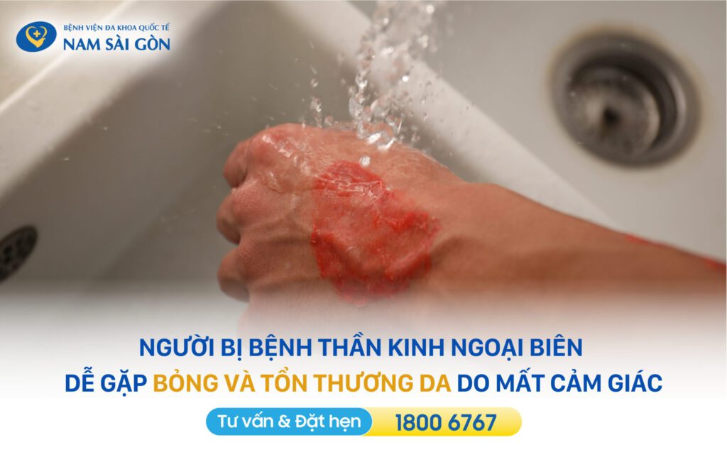 BỆNH THẦN KINH NGOẠI BIÊN - TRIỆU CHỨNG, NGUYÊN NHÂN VÀ PHƯƠNG PHÁP ĐIỀU TRỊ 6 rối loạn thần kinh ngoại biên