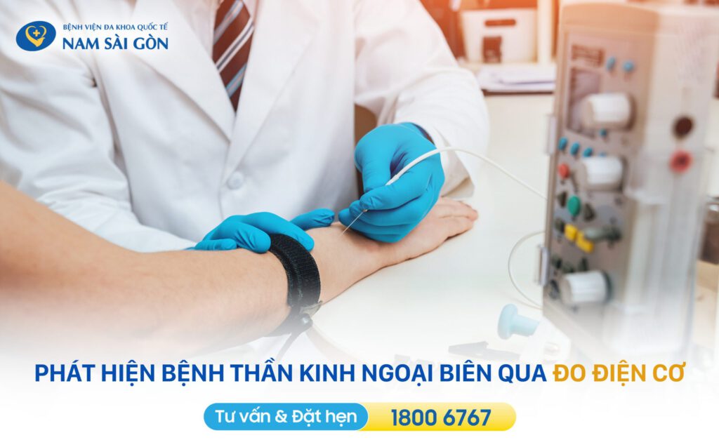 BỆNH THẦN KINH NGOẠI BIÊN - TRIỆU CHỨNG, NGUYÊN NHÂN VÀ PHƯƠNG PHÁP ĐIỀU TRỊ 7 thần kinh ngoại biên
