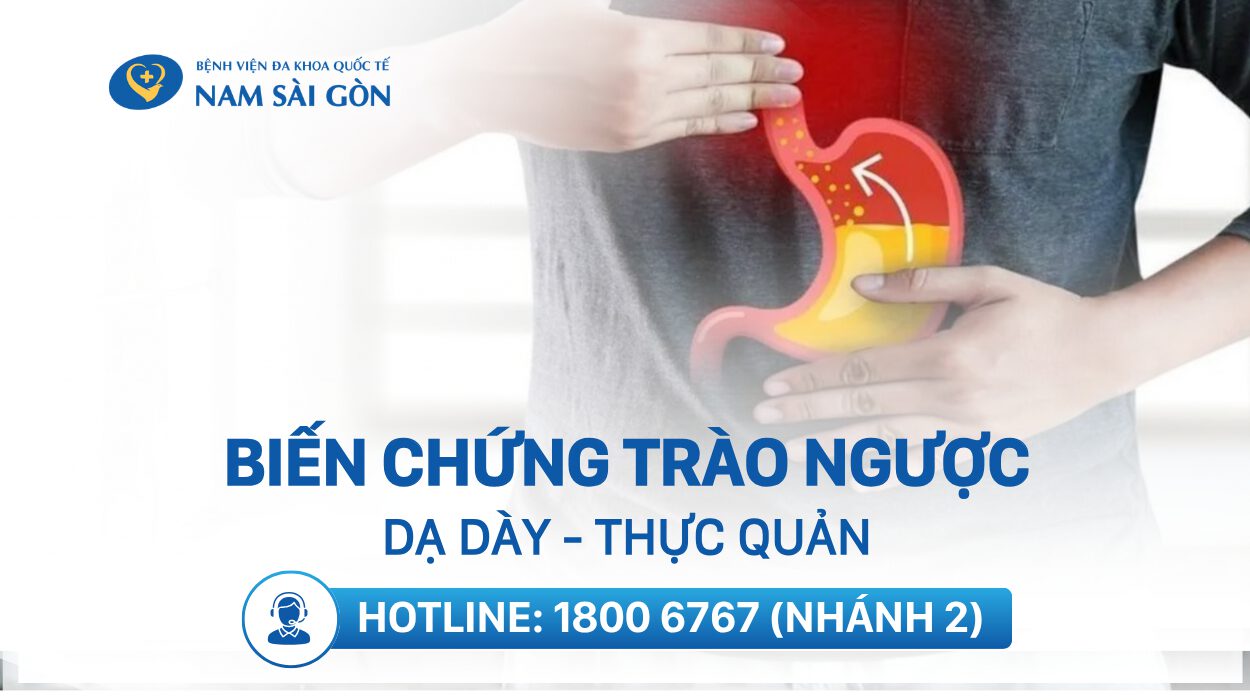 bien-chung-trao-nguoc-da-day-thuc-quan