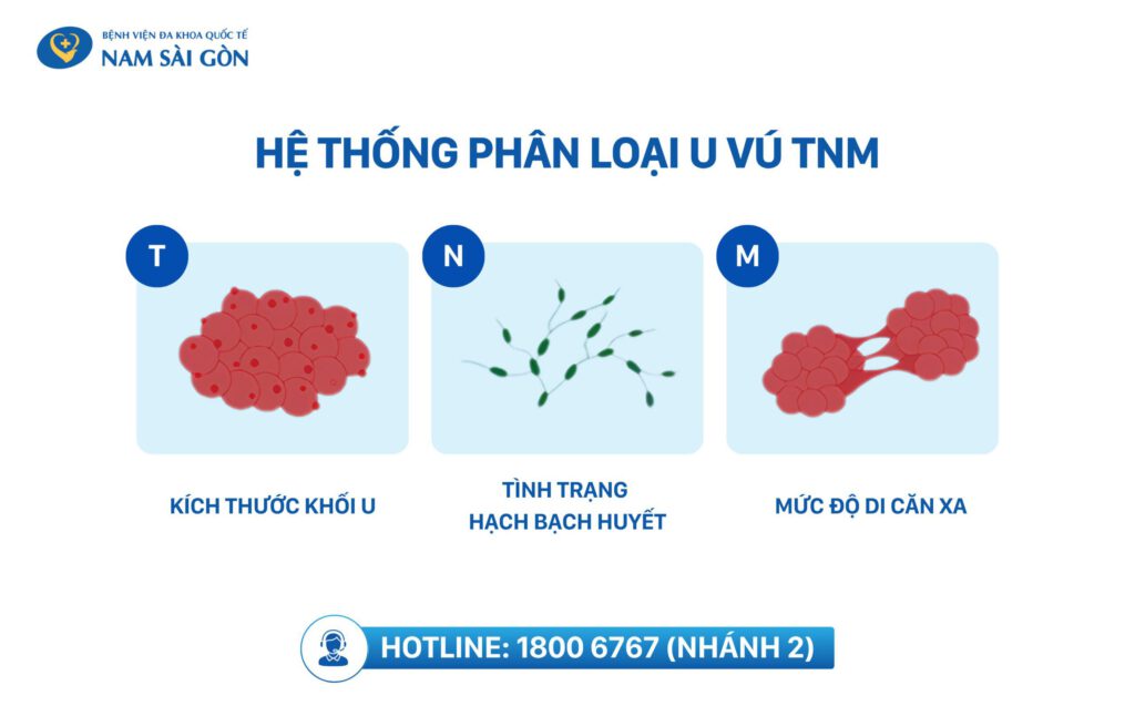 ung thư vú có mấy giai đoạn