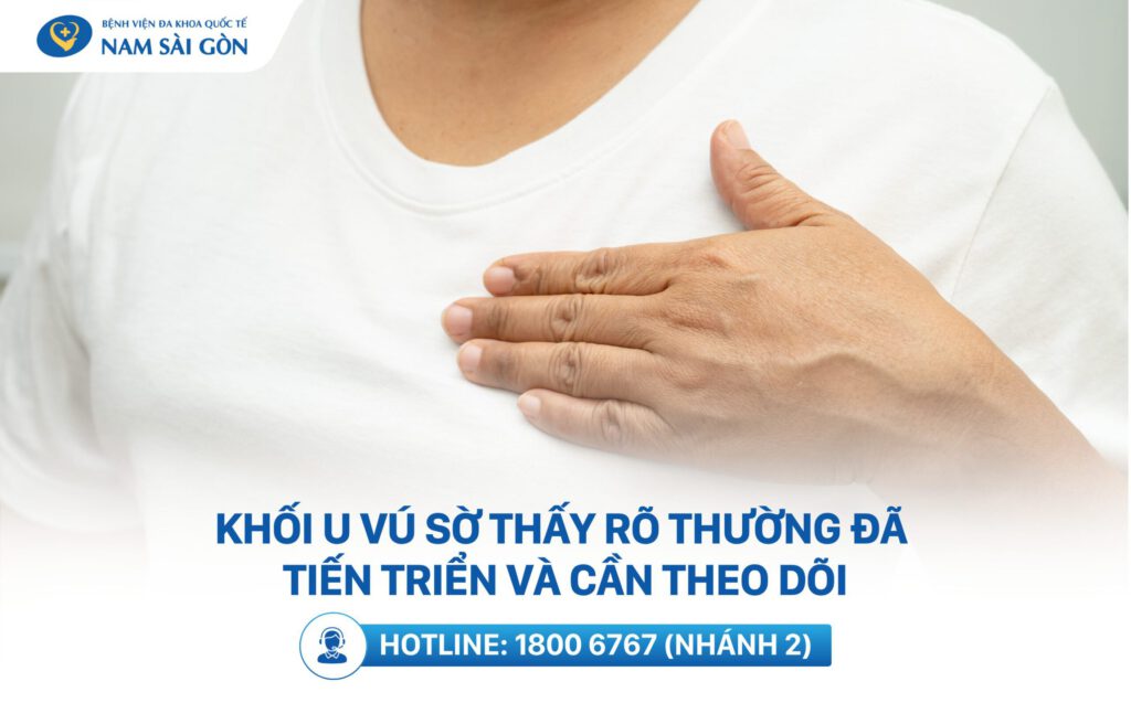 các giai đoạn ung thư vú