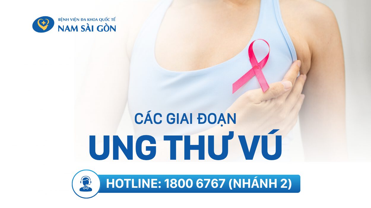 giai-doan-ung-thu-vu