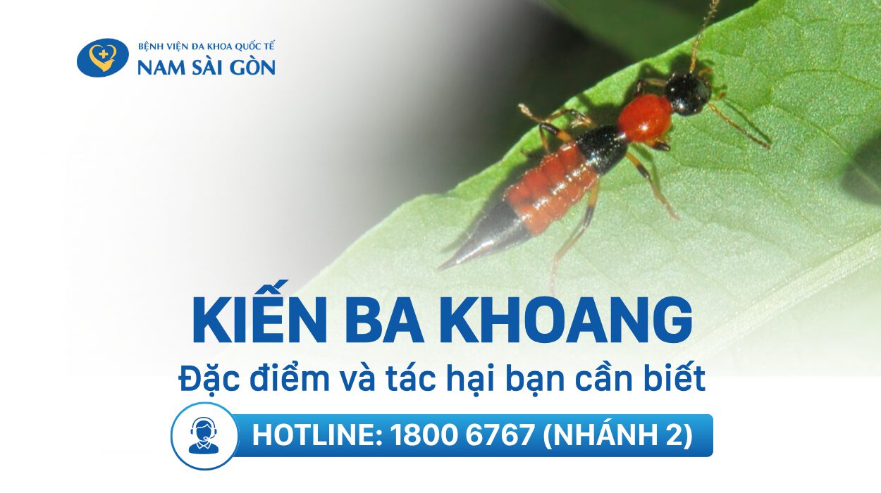 KIẾN BA KHOANG LÀ GÌ? DẤU HIỆU VÀ HÌNH ẢNH KHI BỊ CẮN