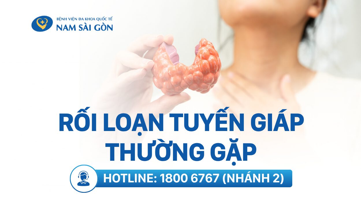 RỐI LOẠN TUYẾN GIÁP – NGUYÊN NHÂN, DẤU HIỆU VÀ CÁCH ĐIỀU TRỊ