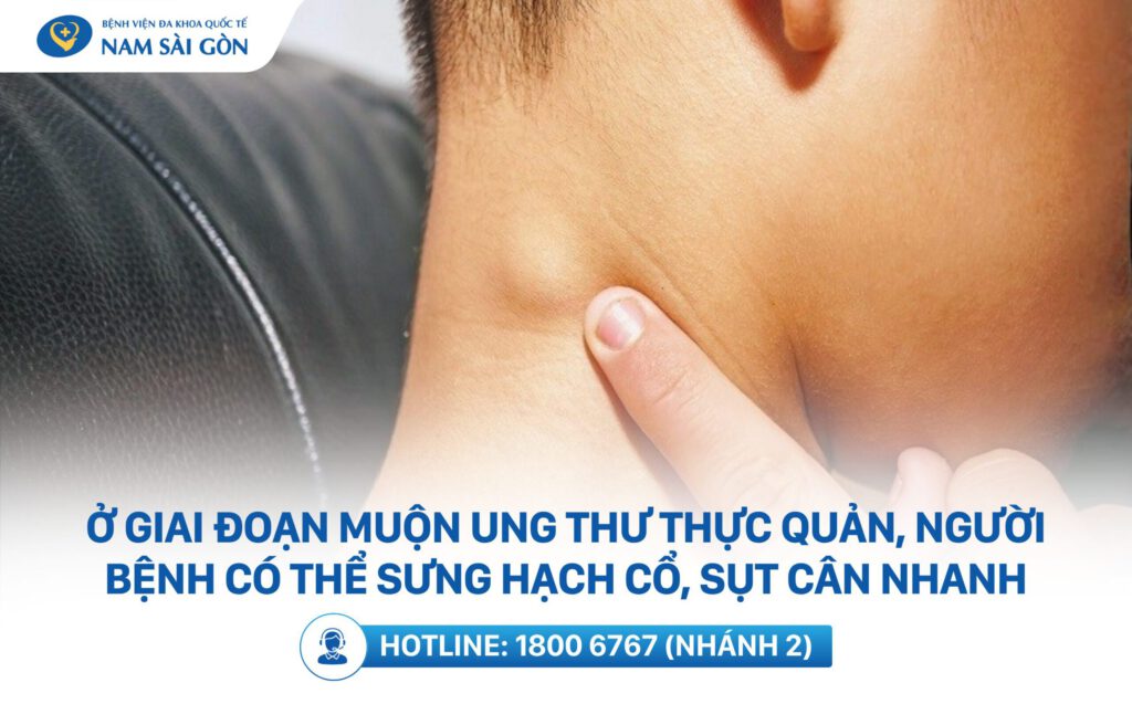 dau-hieu-ung-thu-thuc-quan