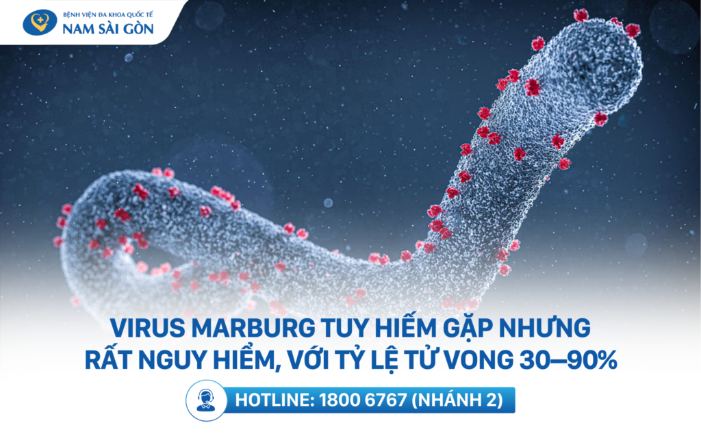 marburg virus là gì