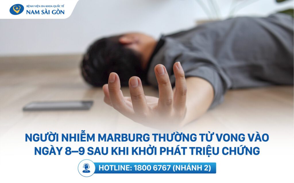 Dấu hiệu khi bị nhiễm Virus Marburg