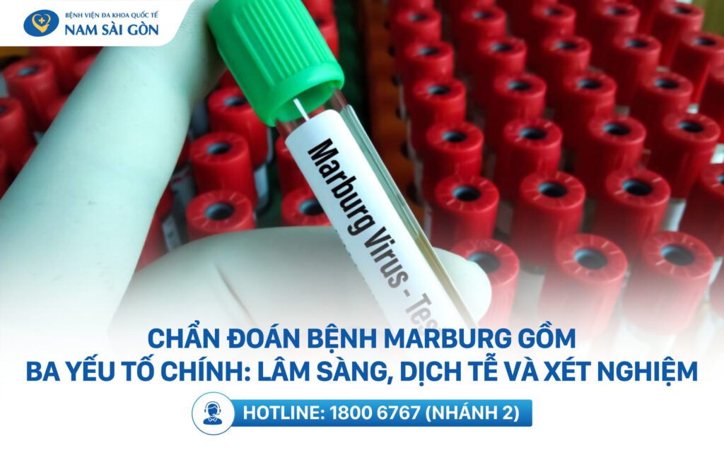 Chẩn đoán khi bị nhiễm virus Marburg