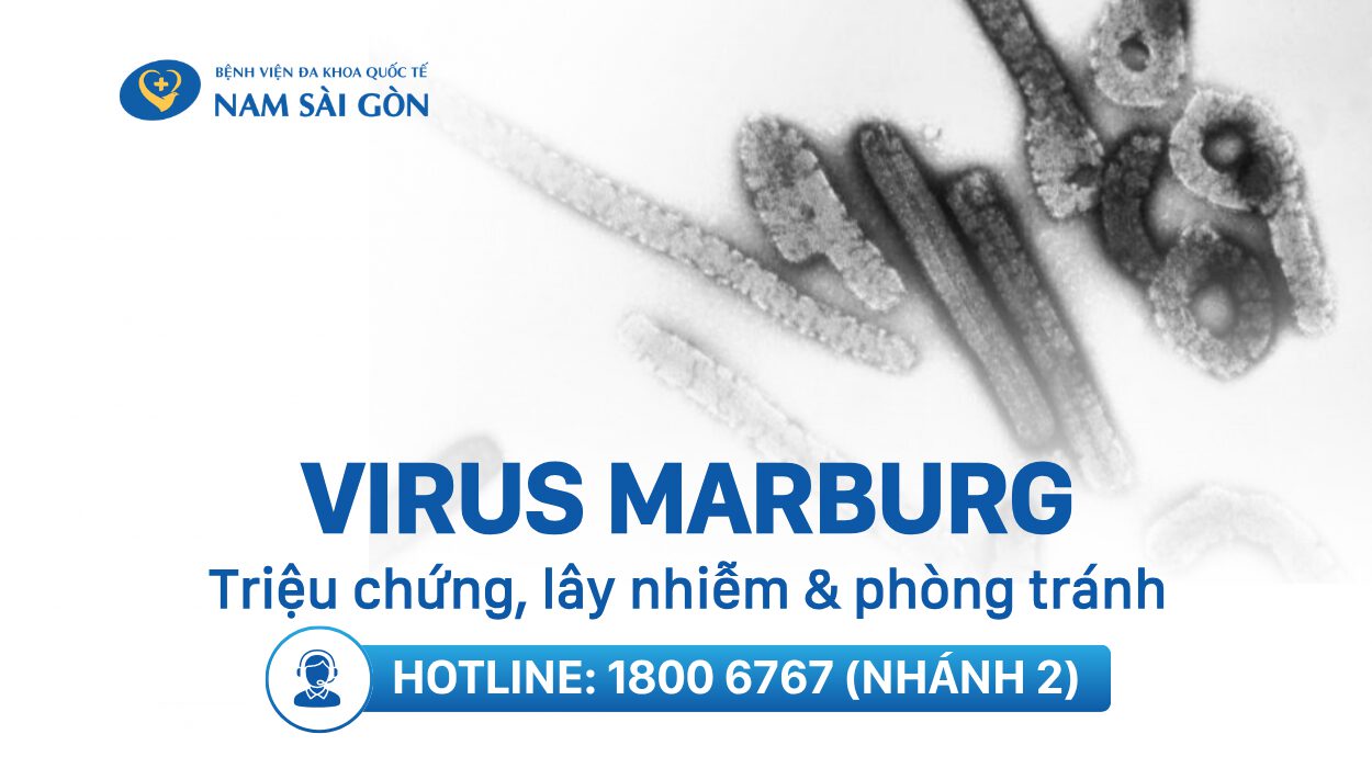 VIRUS MARBURG – TRIỆU CHỨNG, LÂY NHIỄM VÀ CÁCH PHÒNG NGỪA