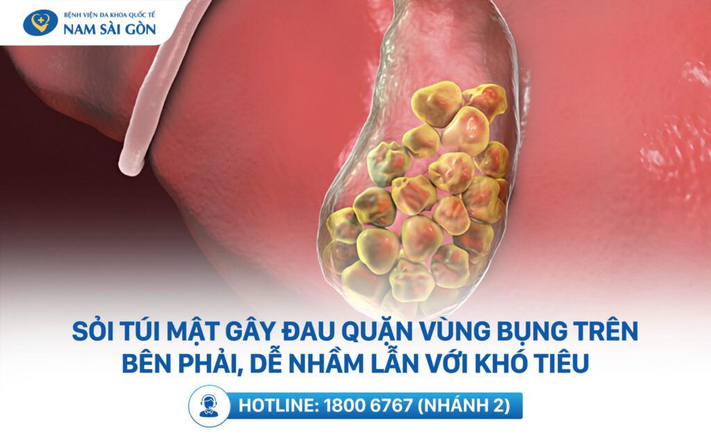 đau bụng dưới bên phải