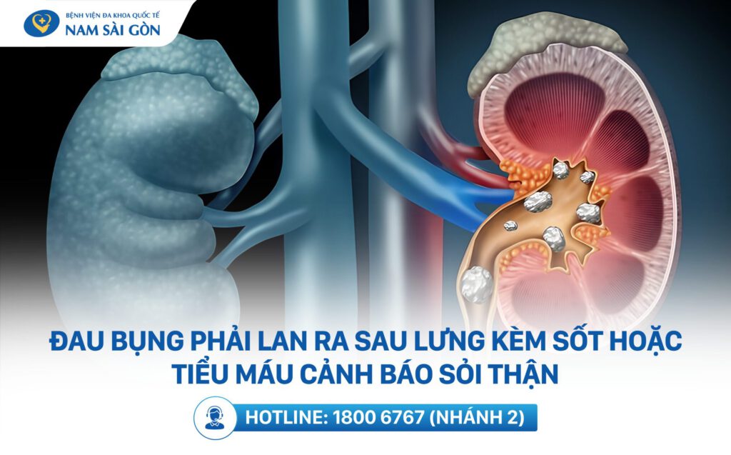 đau bụng bên phải ngang rốn