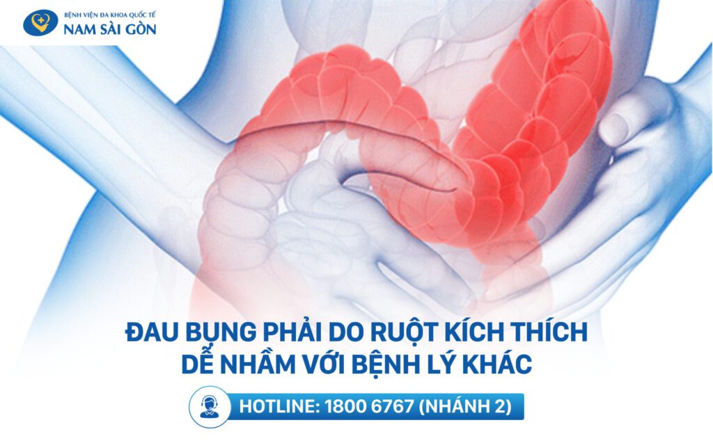 đau bụng dưới bên phải