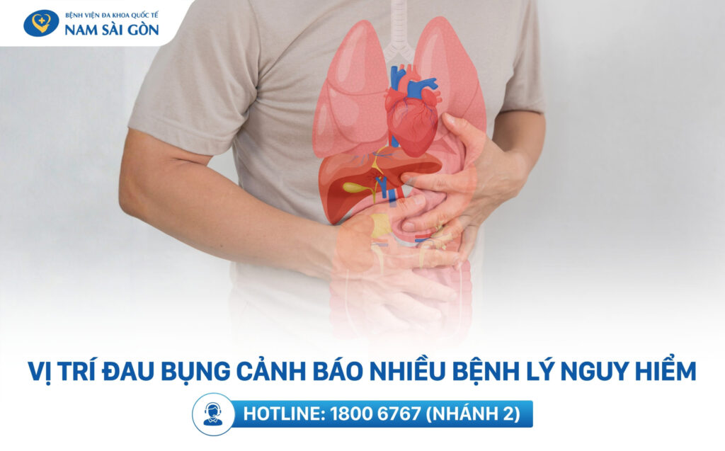 vị trí đau bụng