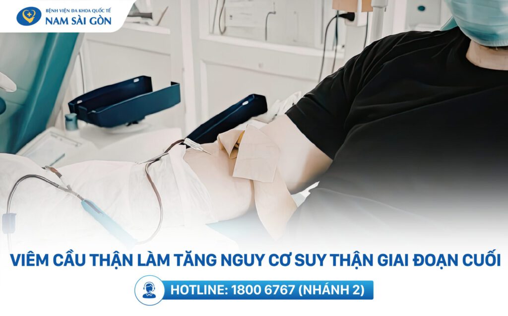 viêm cầu thận gây suy thận