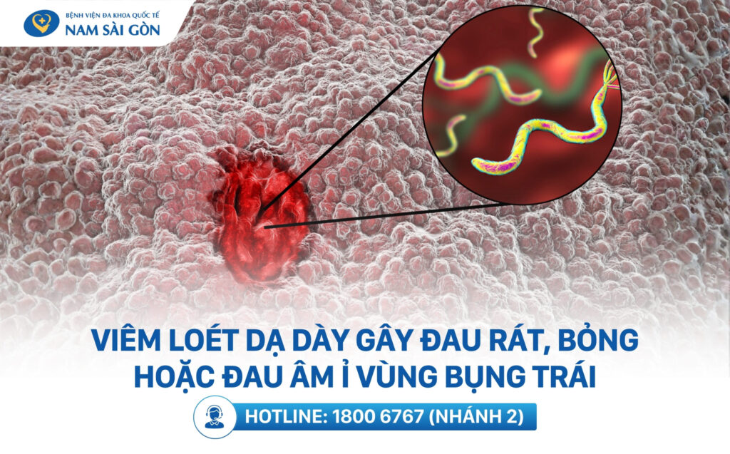 bị đau bụng bên trái ở nữ