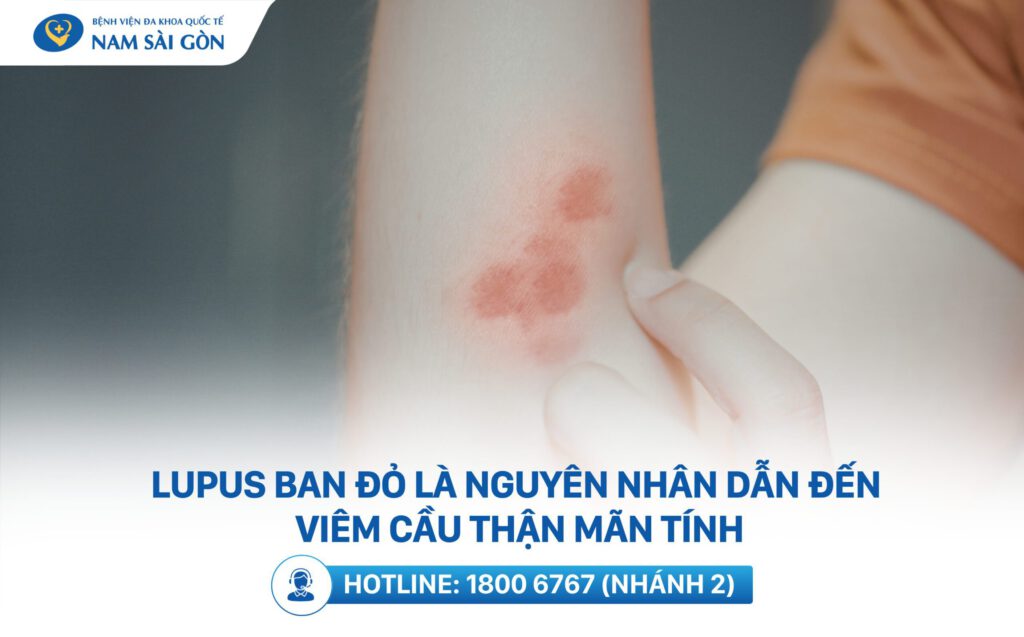 nguyên nhân viêm cầu thận
