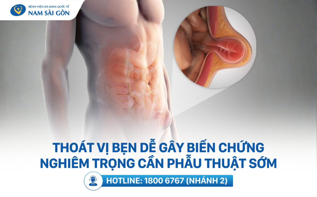 đau bụng trên bên trái
