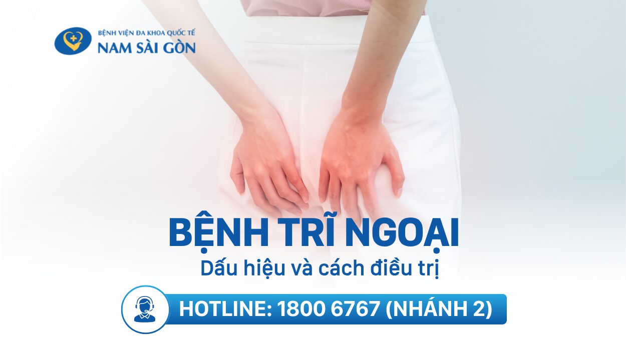Thumbnail Tri ngoai