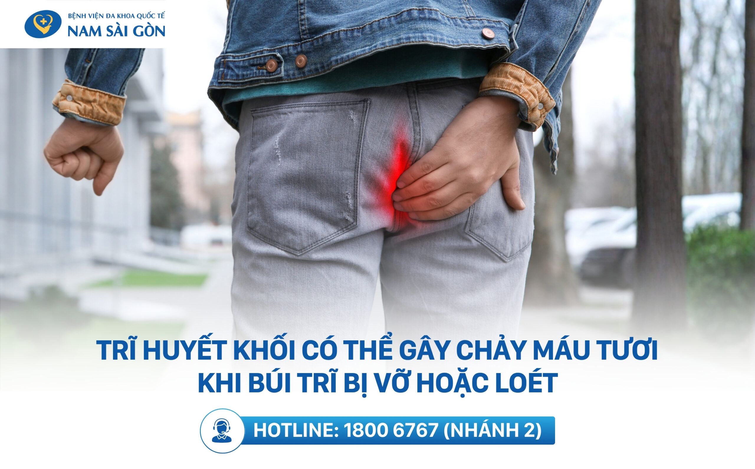 dấu hiệu bệnh trĩ huyết khối