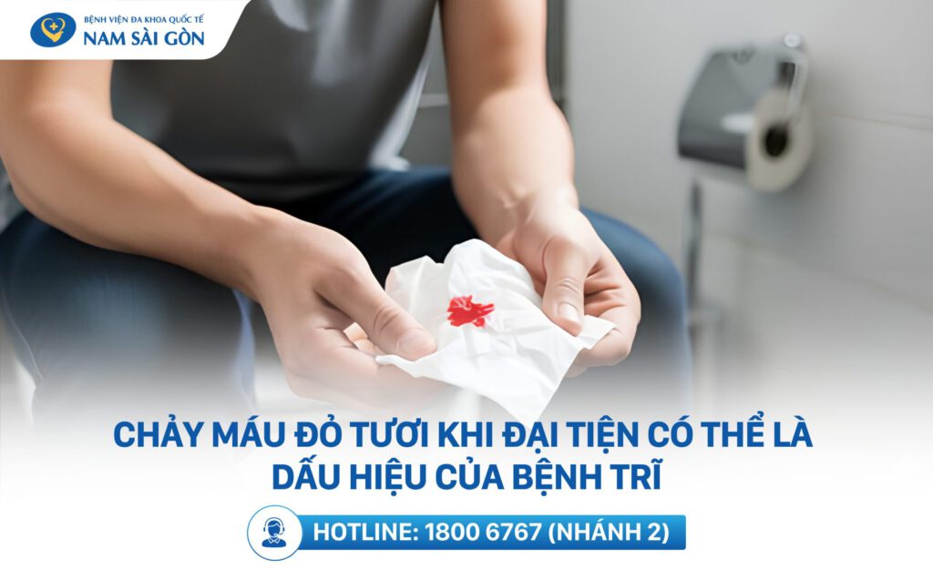 triệu chứng trĩ nội
