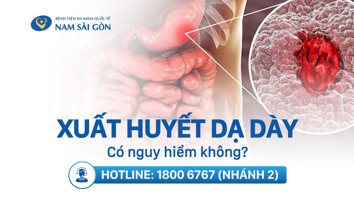 XUẤT HUYẾT DẠ DÀY – NGUYÊN NHÂN, TRIỆU CHỨNG VÀ PHÒNG NGỪA