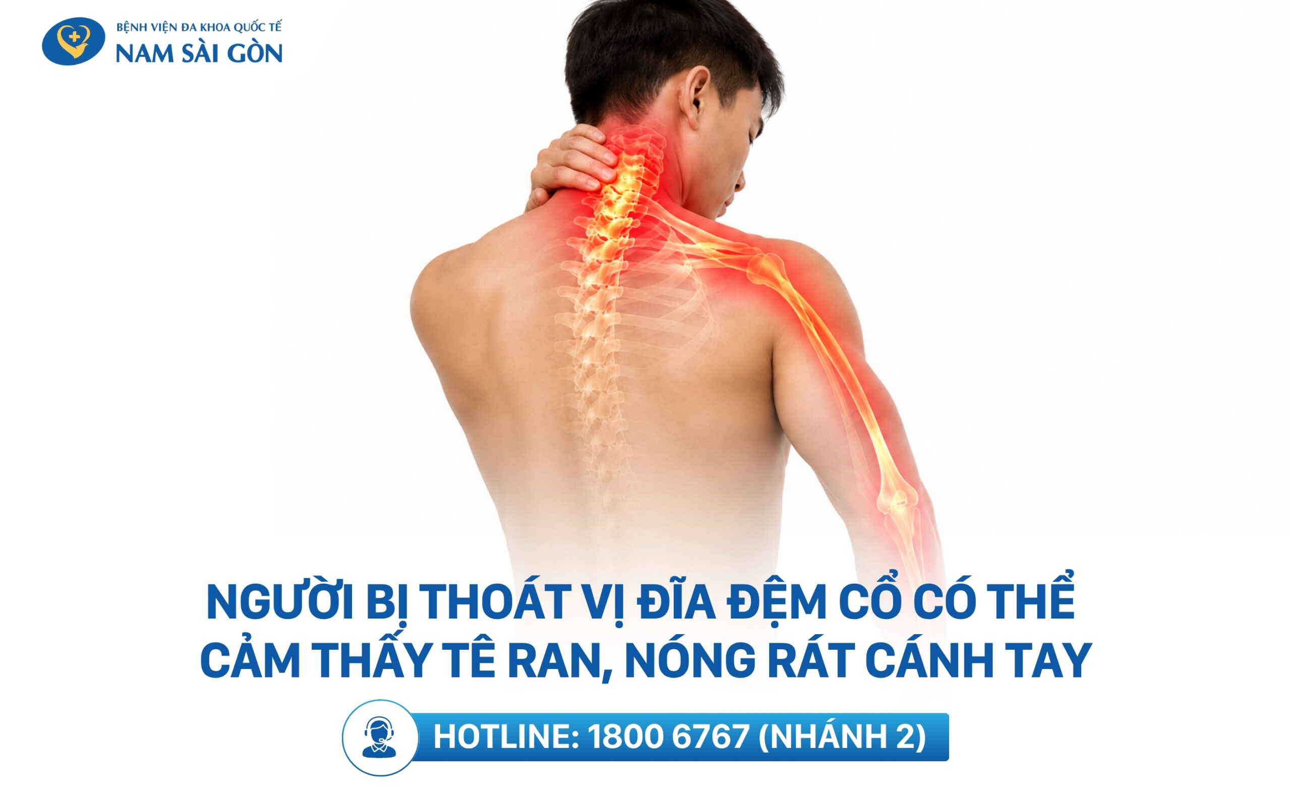 nguyên nhân đau vai gáy