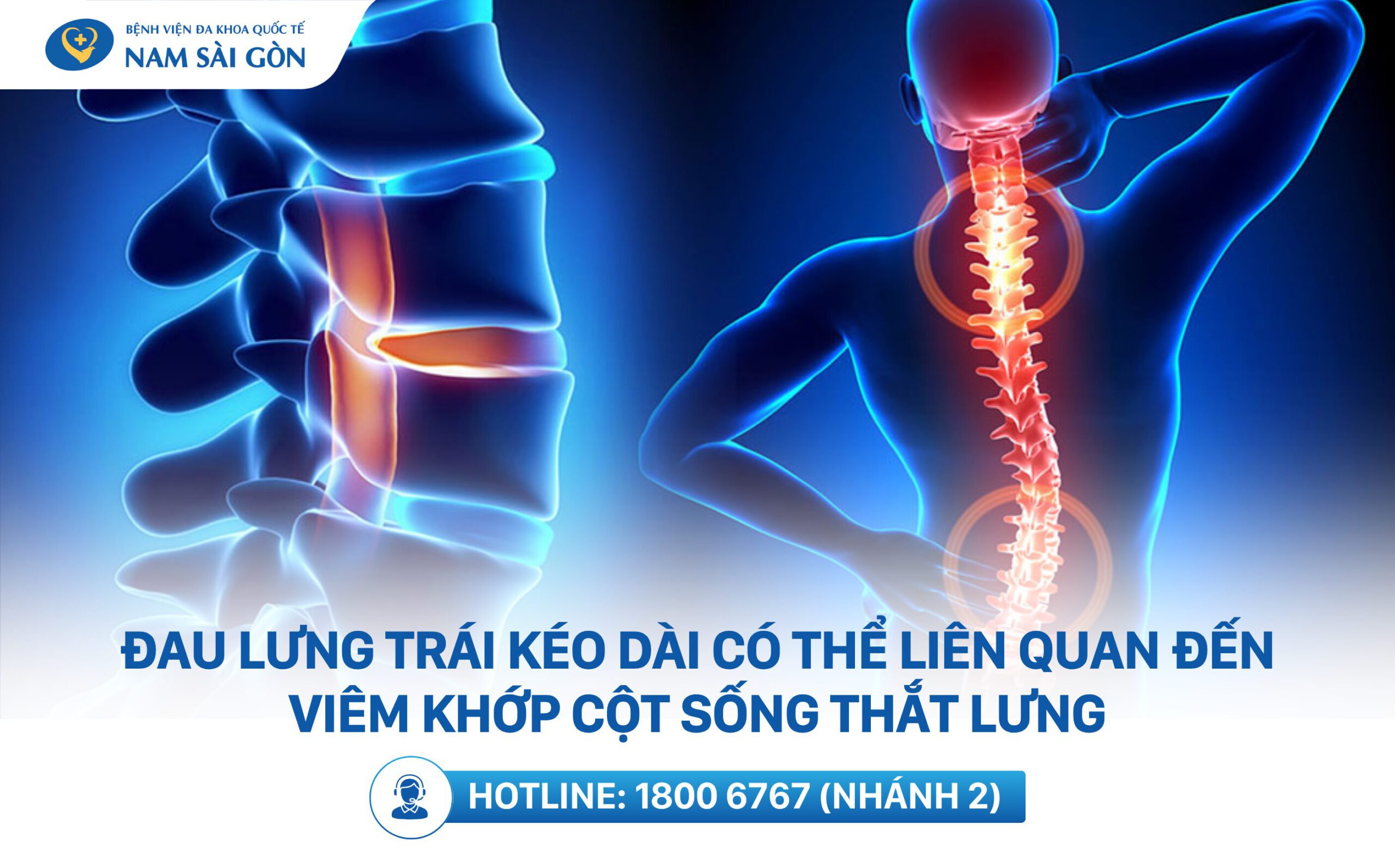 đau sau lưng bên trái