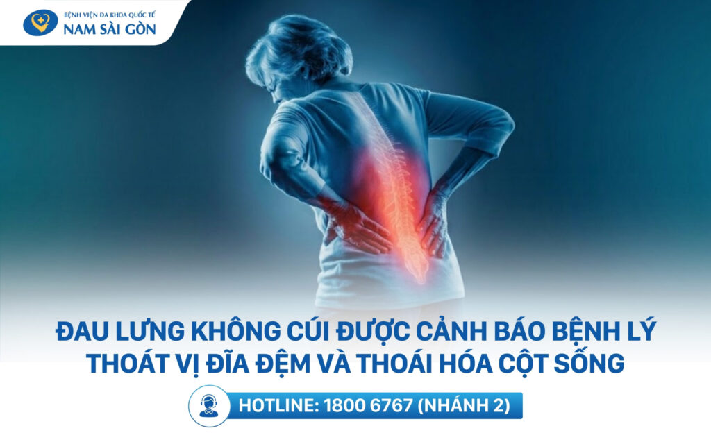 đau lưng không cúi được