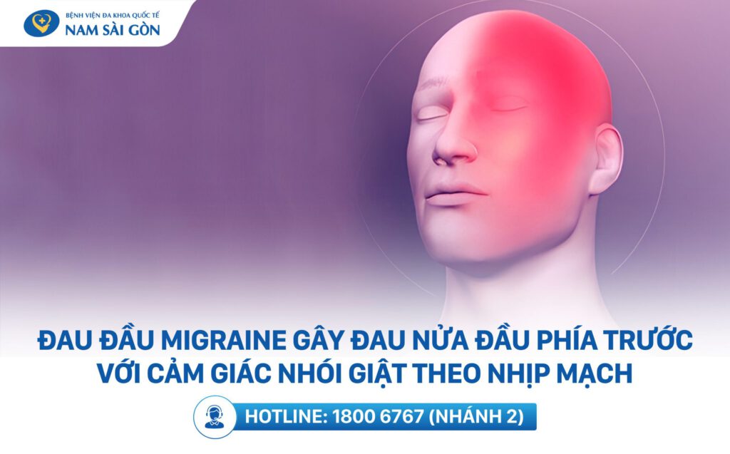 đau nửa đầu trước