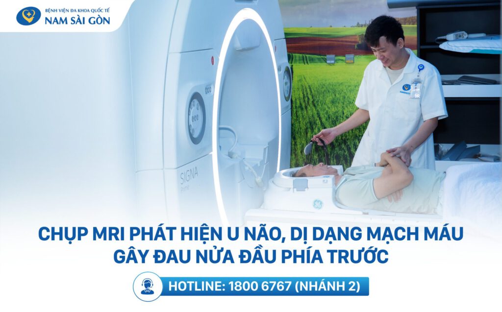 đau đầu phía trước