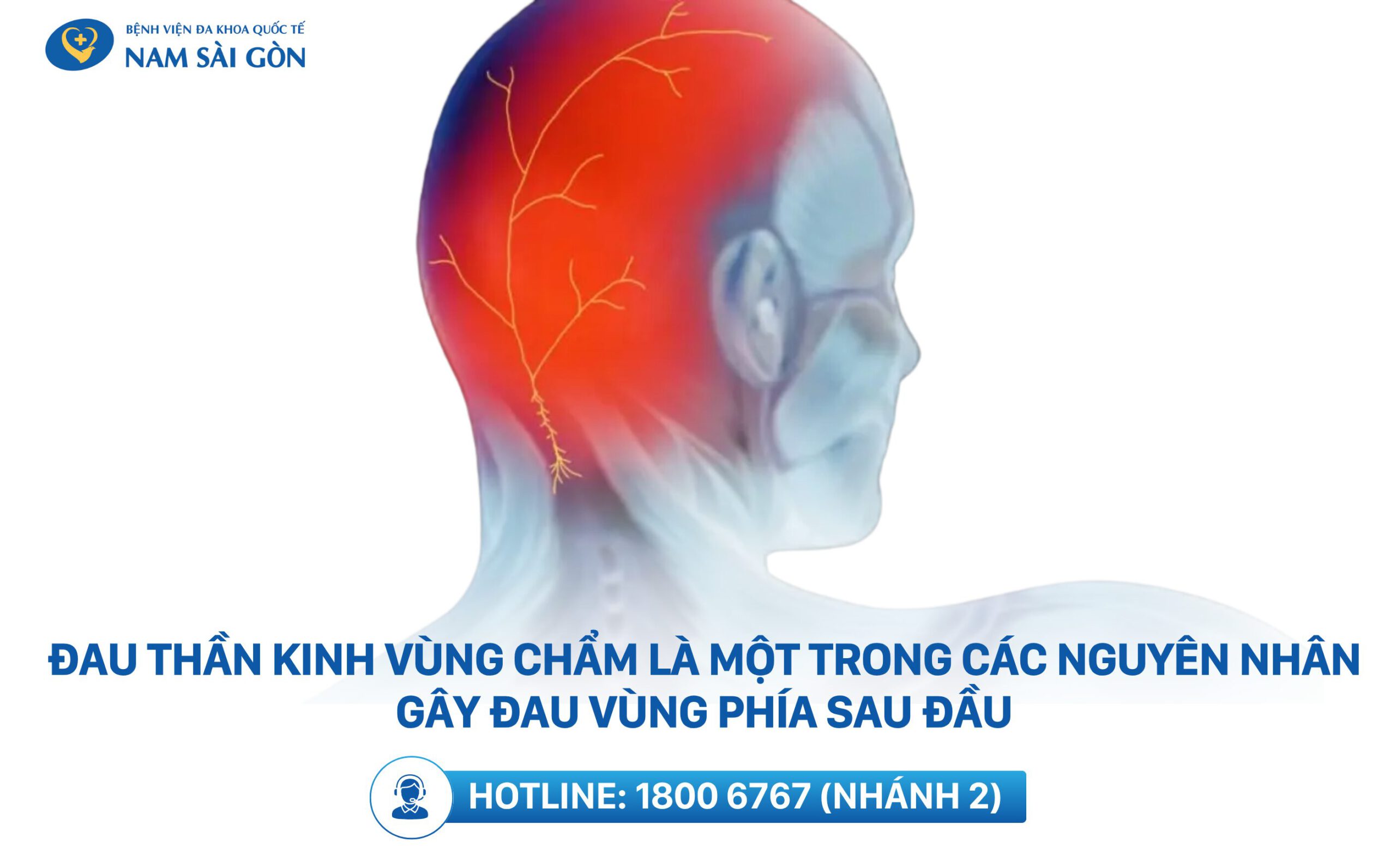 vì sao bị đau nửa đầu sau