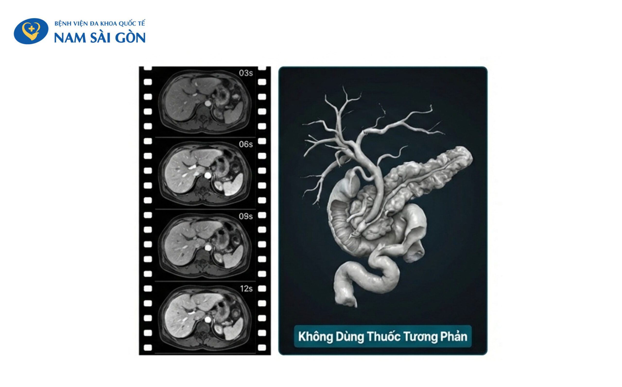He-thong-cong-huong-tu-MRI