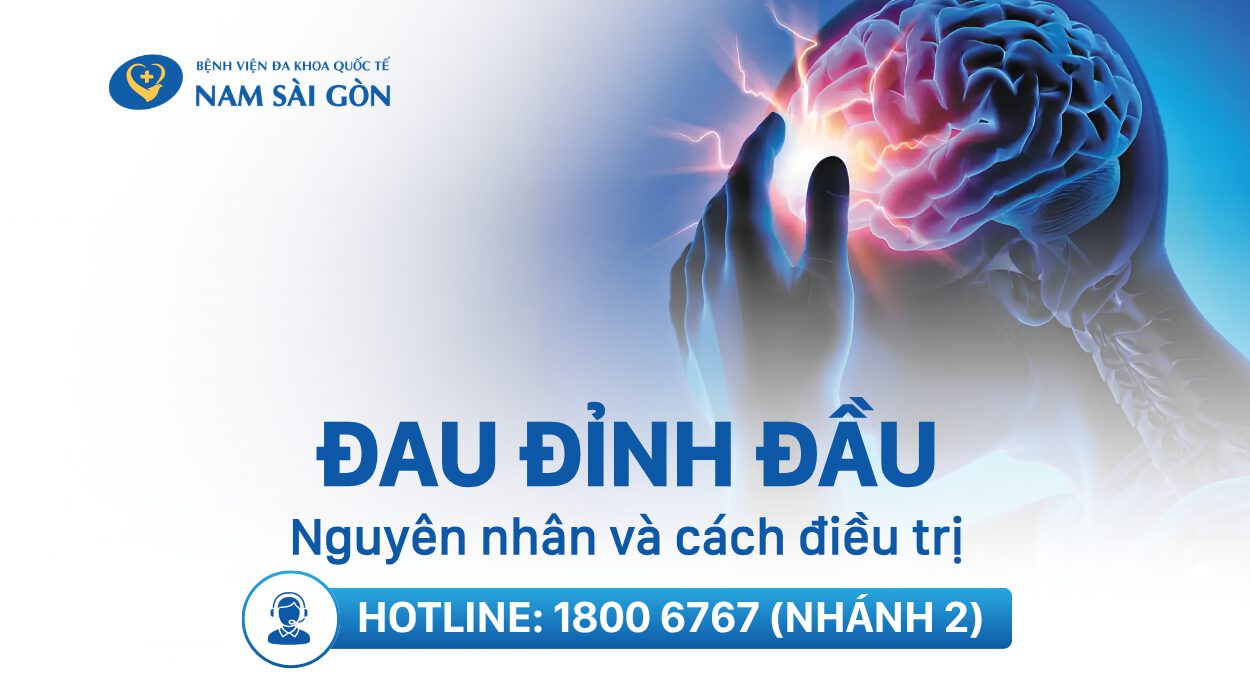 ĐAU ĐỈNH ĐẦU LÀ BỆNH GÌ? NGUYÊN NHÂN VÀ CÁCH ĐIỀU TRỊ