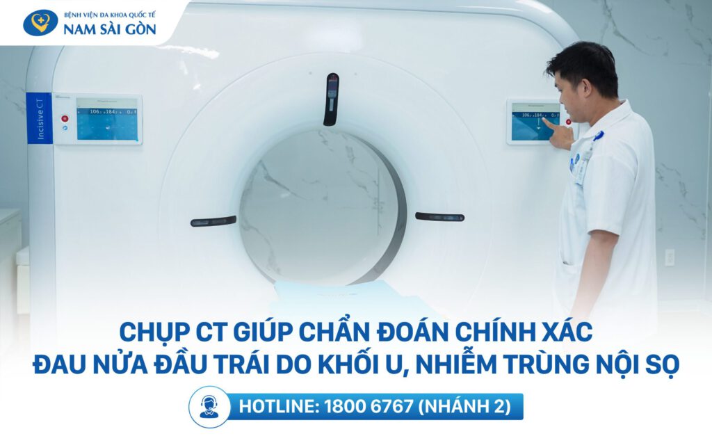 mẹo chữa đau nửa đầu trái