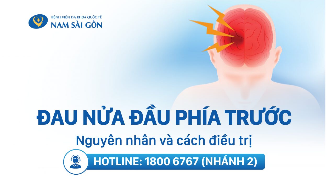 ĐAU NỬA ĐẦU PHÍA TRƯỚC LÀ BỆNH GÌ? NGUYÊN NHÂN VÀ CÁCH ĐIỀU TRỊ