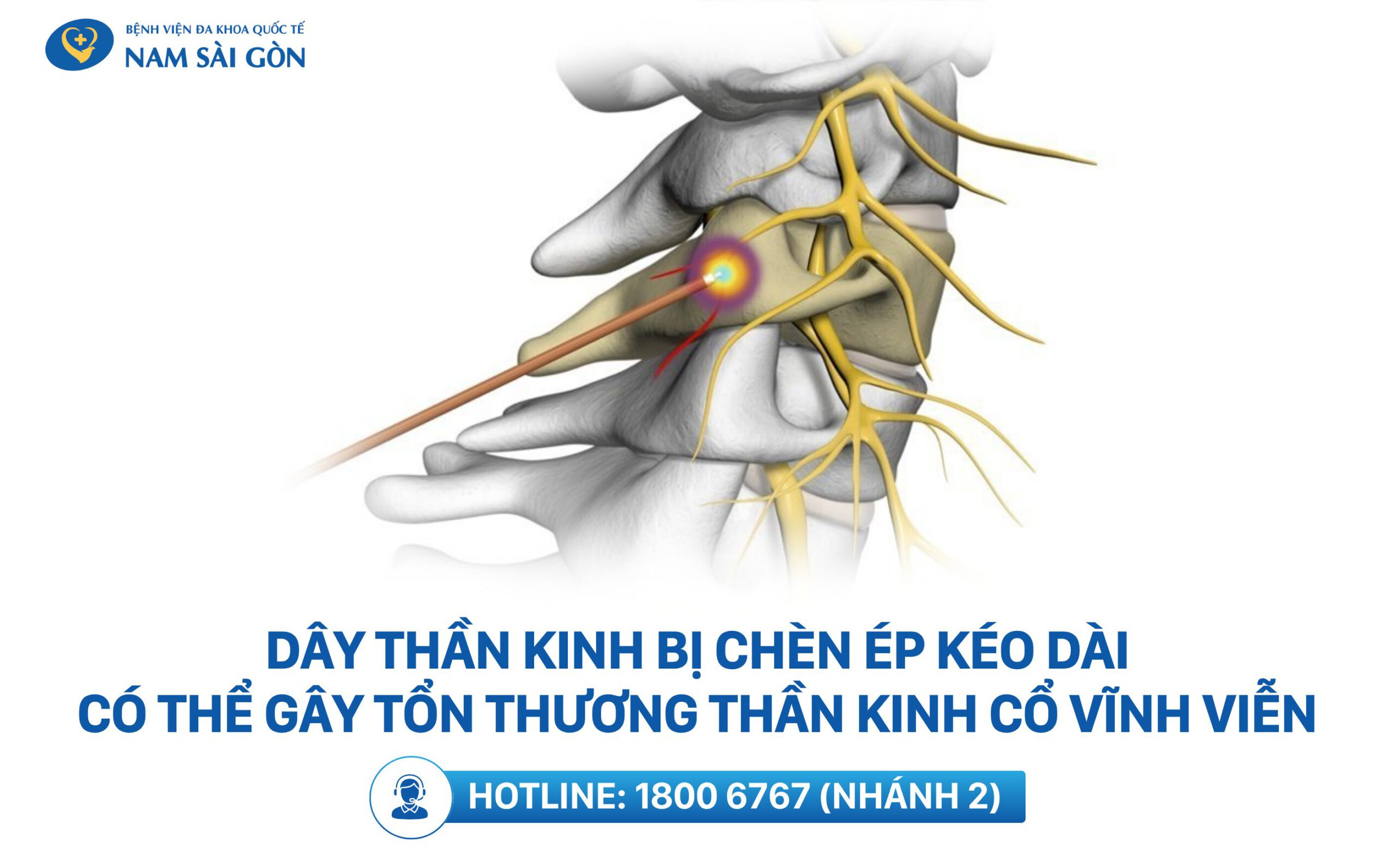 bị đau cổ bên trái