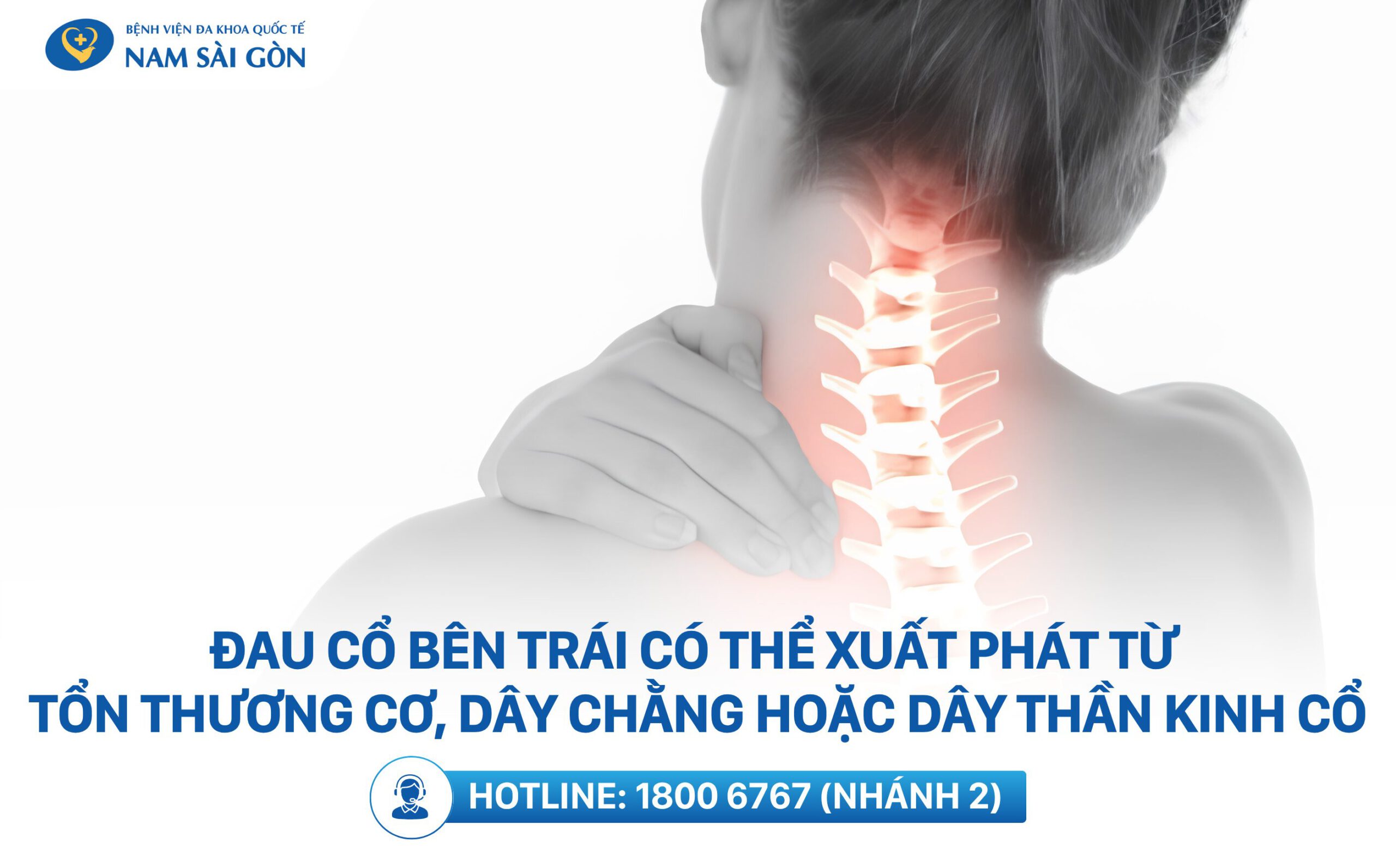Đau cổ bên trái là gì